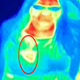 Imagen para el artículo titulado Una mancha en la imagen de una atracción con cámaras térmicas detecta un cáncer a una mujer